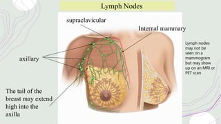 Internal mammary
supraclavicular
axillary
Lymph Nodes
The tail of the
breast may extend
high into the
axilla
Lymph nodes
may not be
seen on a
mammogram
but may show
up on an MRI or
PET scan
 