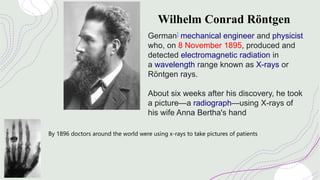 Wilhelm Conrad Röntgen
German] mechanical engineer and physicist
who, on 8 November 1895, produced and
detected electromagnetic radiation in
a wavelength range known as X-rays or
Röntgen rays.
About six weeks after his discovery, he took
a picture—a radiograph—using X-rays of
his wife Anna Bertha's hand
By 1896 doctors around the world were using x-rays to take pictures of patients
 