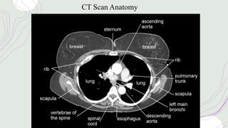 CT Scan Anatomy
 