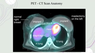 PET - CT Scan Anatomy
 