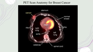 PET Scan Anatomy for Breast Cancer
 