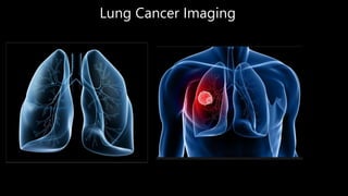 Lung Cancer Imaging
 