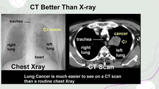 CT Better Than X-ray
 
