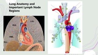 Lung Anatomy and
Important Lymph Node
Regions
 