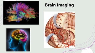 Brain Imaging
 