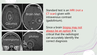 Standard test is an MRI (not a
CT scan) given with
intravenous contrast
(gadolinium).
Since a brain biopsy may not
always be an option it is
critical that the radiologist
can accurately identify the
correct diagnosis
 