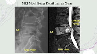 MRI Much Better Detail than an X-ray
 