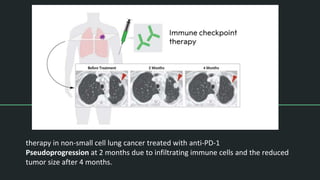 Cancer immmunotherapy | PPTX