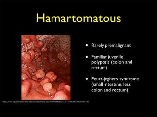 Hamartomatous

                                                                                          •      Rarely premalignant

                                                                                          •      Familiar juvenile
                                                                                                 polyposis (colon and
                                                                                                 rectum)

                                                                                          •      Peutz-Jeghers syndrome
                                                                                                 (small intestine, less
                                                                                                 colon and rectum)

http://www.ngoaikhoathuchanh.info/vn/chitiettintuc.aspx?IDTT=1042011113514&IDLOAI=266201002348
 