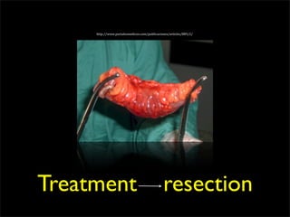 http://www.portalesmedicos.com/publicaciones/articles/889/2/




Treatment                                     resection
 