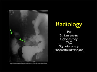 Radiology
                                                                                 Rx
                                                                           Barium enema
                                                                            Colonoscopy
                                                                                TAC
                                                                           Sigmoidoscopy
                                                                        Endorectal ultrasound


http://hnsebimagenes.blogspot.com/2009/01/cncer‐de‐colon‐derecho.html
 