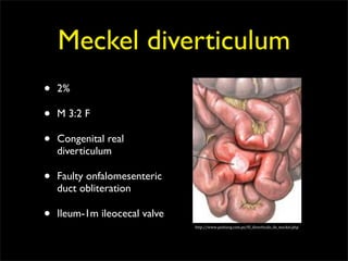 Meckel diverticulum
•   2%

•   M 3:2 F

•   Congenital real
    diverticulum

•   Faulty onfalomesenteric
    duct obliteration

•   Ileum-1m ileocecal valve
                               http://www.pedsurg.com.pe/El_diverticulo_de_meckel.php
 