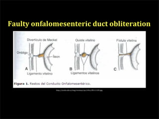 Faulty onfalomesenteric duct obliteration




             http://scielo.sld.cu/img/revistas/rpr/v9n1/f0111105.jpg
 