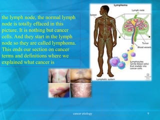 cancer etiology 9
the lymph node, the normal lymph
node is totally effaced in this
picture. It is nothing but cancer
cells. And they start in the lymph
node so they are called lymphoma.
This ends our section on cancer
terms and definitions where we
explained what cancer is
 