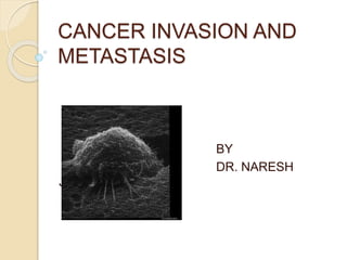 CANCER INVASION AND
METASTASIS
BY
DR. NARESH
JANGID
 