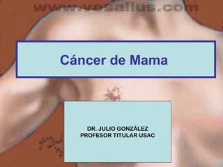 Cáncer de Mama 
DR. JULIO GONZÁLEZ 
PROFESOR TITULAR USAC 
 
