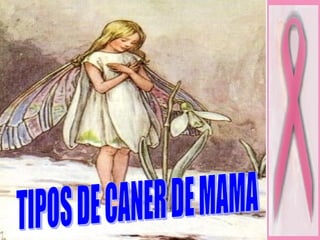 TIPOS DE CANER DE MAMA 
