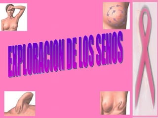 EXPLORACION DE LOS SENOS 