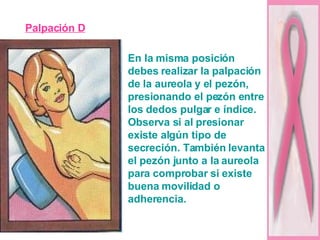 Palpación D En la misma posición debes realizar la palpación de la aureola y el pezón, presionando el pezón entre los dedos pulgar e índice. Observa si al presionar existe algún tipo de secreción. También levanta el pezón junto a la aureola para comprobar si existe buena movilidad o adherencia.  