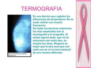 TERMOGRAFIA  Es una técnica que registra las diferencias de temperatura. No se suele utilizar con mucha frecuencia.  De todas las técnicas anteriores, las más empleadas son la mamografía y la ecografía. Si existe alguna duda, que no se solucione con estas dos, se emplea las otras. Ninguna es mejor que la otra sino que con cada una se ve la zona corporal de una manera diferente.  