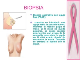 BIOPSIA Biopsia aspirativa con aguja fina (PAAF) : consiste en introducir una aguja hasta la zona del tumor, mientras el médico palpa la masa. Si la masa no puede palparse, se puede realizar esta técnica con ayuda de la ecografía para situar la aguja en el sitio exacto donde se encuentre la masa. Después se extraerá el líquido con la aguja.   