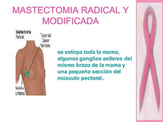 MASTECTOMIA RADICAL Y MODIFICADA se extirpa toda la mama, algunos ganglios axilares del mismo brazo de la mama y una pequeña sección del músculo pectoral.. 