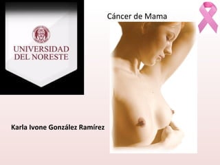 Karla Ivone González Ramírez
Cáncer de Mama
 