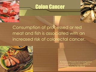 Colon Cancer 
Consumption of processed or red 
meat and fish is associated with an 
increased risk of colorectal cancer. 
European Prospective Investigation 
into Cancer and Nutrition (EPIC) is 
coordinated by Dr Elio Riboli 
 