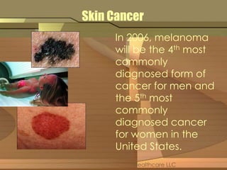 Skin Cancer 
In 2006, melanoma 
will be the 4th most 
commonly 
diagnosed form of 
cancer for men and 
the 5th most 
commonly 
diagnosed cancer 
for women in the 
United States. 
Healthcare LLC 
 