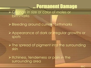 … Permanent Damage 
 Change in size or color of moles or 
birthmarks 
 Bleeding around current birthmarks 
Appearance of dark or irregular growths or 
spots 
 The spread of pigment into the surrounding 
skin 
 Itchiness, tenderness or pain in the 
surrounding area 
BBC 
 