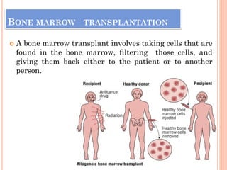 BONE MARROW TRANSPLANTATION
 A bone marrow transplant involves taking cells that are
found in the bone marrow, filtering those cells, and
giving them back either to the patient or to another
person.
 