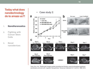 Today what does 
nanotechnology 
do to amaze us?! 
1. Nanotheranostics 
2. Fighting with 
Cancer Stem 
Cells 
3. Novel 
nanodevices 
• Case study 2: 
10 
Yang, Kai, et al. "Multimodal imaging guided photothermal therapy using functionalized graphene 
nanosheets anchored with magnetic nanoparticles."Advanced materials 24.14 (2012): 1868-1872. 
 