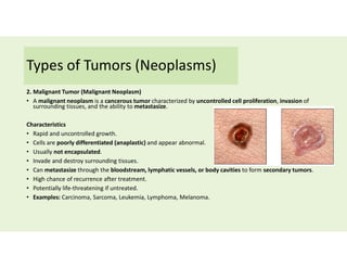Types of Tumors (Neoplasms)
2. Malignant Tumor (Malignant Neoplasm)
• A malignant neoplasm is a cancerous tumor characterized by uncontrolled cell proliferation, invasion of
surrounding tissues, and the ability to metastasize.
Characteristics
• Rapid and uncontrolled growth.
• Cells are poorly differentiated (anaplastic) and appear abnormal.
• Usually not encapsulated.
• Invade and destroy surrounding tissues.
• Can metastasize through the bloodstream, lymphatic vessels, or body cavities to form secondary tumors.
• High chance of recurrence after treatment.
• Potentially life-threatening if untreated.
• Examples: Carcinoma, Sarcoma, Leukemia, Lymphoma, Melanoma.
 
