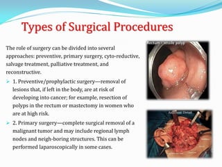 Types of Surgical Procedures
The role of surgery can be divided into several
approaches: preventive, primary surgery, cyto-reductive,
salvage treatment, palliative treatment, and
reconstructive.
 1. Preventive/prophylactic surgery—removal of
lesions that, if left in the body, are at risk of
developing into cancer; for example, resection of
polyps in the rectum or mastectomy in women who
are at high risk.
 2. Primary surgery—complete surgical removal of a
malignant tumor and may include regional lymph
nodes and neigh-boring structures. This can be
performed laparoscopically in some cases.
 