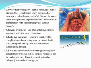  3. Cytoreductive surgery—partial removal of bulk of
disease. This is performed when the spread of
tumor precludes the removal of all disease. In some
cases, this approach improves survival when used in
combination with chemotherapy (ie, ovarian
cancer).
 4. Salvage treatment—use of an extensive surgical
approach to treat a local recurrence.
 5. Palliative treatment—attempts to relieve the
complications of cancer (eg, obstruction of the GI
tract, pain produced by tumor extension into
surrounding nerves).
 6. Reconstructive/rehabilitative surgery—repair of
defects from previous radical surgical resection; can
be performed early (breast reconstruction) or
delayed (head and neck surgery).
 
