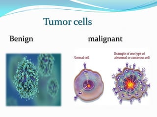Tumor cells
Benign malignant
 