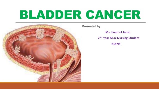 Cancer of bladder
