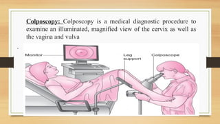 cancer of cervix and its management 2.pptx