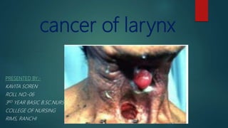 cancer of larynx
PRESENTED BY:-
KAVITA SOREN
ROLL NO.-06
3RD YEAR BASIC B.SC.NURSING
COLLEGE OF NURSING
RIMS, RANCHI
 
