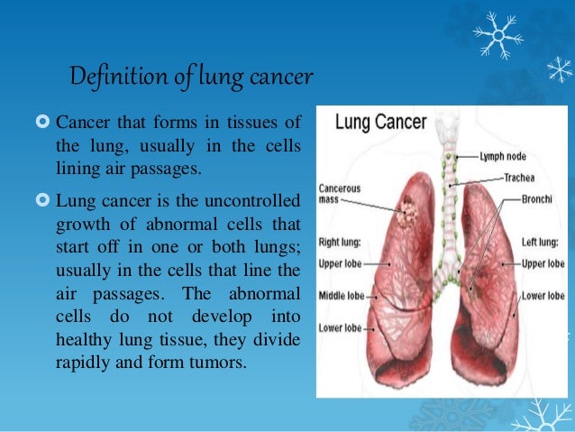 Cancer Of Larynx And Lungs