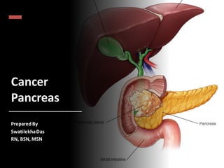 Cancer
Pancreas
Prepared By
SwatilekhaDas
RN, BSN, MSN
 