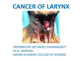 CANCER OF LARYNX
PREPARED BY: MS SAHELI CHAKRABORTY
M.Sc. NURSING
INDIAN ACADEMY COLLEGE OF NURSING
 