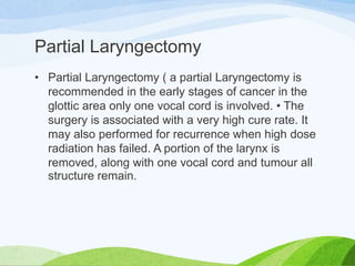 Cancer of the larynx
