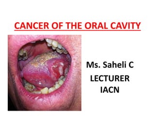 CANCER OF THE ORAL CAVITY
Ms. Saheli C
LECTURER
IACN
 