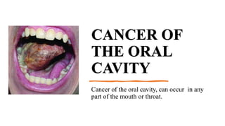 cancer-of-the-oral-cavity-rahul-sir-pptx
