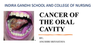 CANCER OF
THE ORAL
CAVITY
BY;
ANUSHRI SRIVASTAVA
INDIRA GANDHI SCHOOL AND COLLEGE OF NURSING
 