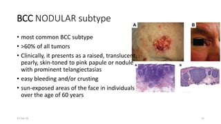 Cancer of the skin | PPTX