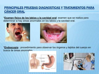 PRINCIPALES PRUEBAS DIAGNOSTICAS Y TRATAMIENTOS PARA
CÁNCER ORAL
*Examen físico de los labios y la cavidad oral: examen que se realiza para
determinar si hay áreas anormales en los labios y la cavidad oral.
*Endoscopia : procedimiento para observar los órganos y tejidos del cuerpo en
busca de áreas anormales.
 
