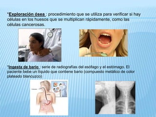 *Exploración ósea : procedimiento que se utiliza para verificar si hay
células en los huesos que se multiplican rápidamente, como las
células cancerosas.
*Ingesta de bario : serie de radiografías del esófago y el estómago. El
paciente bebe un líquido que contiene bario (compuesto metálico de color
plateado blancuzco)
 