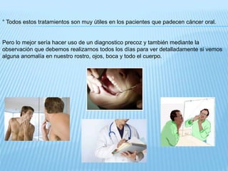 ° Todos estos tratamientos son muy útiles en los pacientes que padecen cáncer oral.
Pero lo mejor sería hacer uso de un diagnostico precoz y también mediante la
observación que debemos realizarnos todos los días para ver detalladamente si vemos
alguna anomalía en nuestro rostro, ojos, boca y todo el cuerpo.
 
